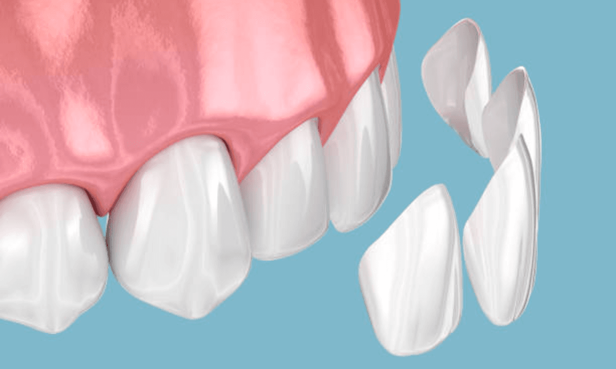 Cosmetic Dentistry